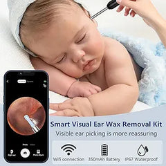 (Free Delivery) 🤩 Smart Wireless Ear Cleaning Camera – HD Visual Otoscope with 360° View (Android & iOS)