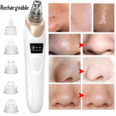 5-in-1 Rechargeable Pore Cleaner – Gentle Suction Facial Care Tool