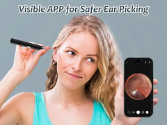 (Free Delivery) 🤩 Smart Wireless Ear Cleaning Camera – HD Visual Otoscope with 360° View (Android & iOS)